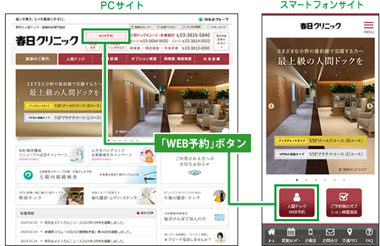 WEB予約
