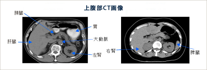 Ct と は